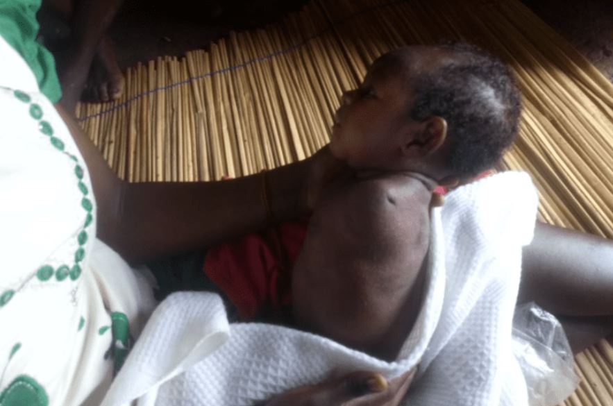 Busia Couple Laments Discrimination after Birth of Baby without Arms